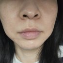 더마랩 | 마산피부관리 마산슈퍼젝션 전문점 조엘랑더마랩 슈퍼젝션 씨파우더 후기