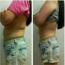 에버바이오 이미지