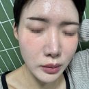 부자한의원 | 신사동 한의원 해초필링 2회차 후기｜트러블 줄고 피부결 살아나는 중!