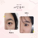 서현약품 | 샤인뷰티 분당 서현역 속눈썹펌 후기 뷰러 쓰지 마세요