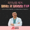 광진구 피지낭종 제거 할 때, 어디 병원가야 할지 선택 팁