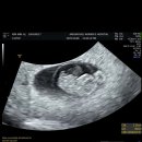 행복식품나라 | [임신 8-9주] 배찌, 엽산, 철분제 국민행복 국가 바우처 신청방법+ 일상유희 다이어리 후기