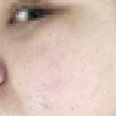 보라에스테틱 - 청주시 흥덕구 풍년로120번길 15 | 청주 마사지 피부관리 추천 에스테틱 보라뷰티 청주본점 수분관리 후기