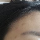 프라블