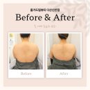 신안 북부 하나 어린이집 | 다산 피부관리 올가드림뷰티 다산신안점 문제성피부/모낭충검사/물광관리 목 어깨 두피 초음파 관리