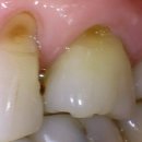 더연세퍼스트치과병원 이미지