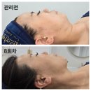 조직의 군살을 빼드립니다: 워크 다이어트 | 부종·셀룰라이트 걱정 끝! 관악구 전신관리로 매끈한 라인 만들기 [보라매피부관리]