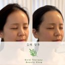 지금은;skin&body | 김해 장유 골드테라피 2회차 후기｜온다웨이브, 써마튠, 아이튠 관리 받고 왔어요