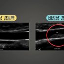 장민욱뇌비게이션신경과의원 이미지