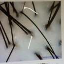 체리아로마테라피 | 쌤 갱년기 탈모 상담 후기 | 탈모 가족력 걱정 끝...기반 맞춤 두피케어 + 이어테라피(KBS 출연 전문가)