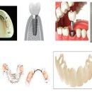 이치과기공소 이미지