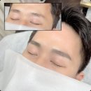 비비네