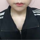 브이케어 | 마미케어 ems 브이쎄라 내돈내산 찐 후기