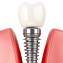 우면본치과의원 이미지