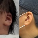 힘내라병원 | 40주5일에 유도분만 실패하고 응급제왕 썰 푼다 1 (광안자모여성병원 제왕후기 1.2일)