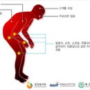 세계 파킨슨병의 날 이미지