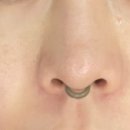 영플러스메디칼 이미지