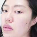 태의스킨