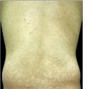 소예피부과의원 이미지