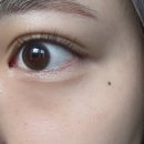 뷰티나린 | 부산 전포 피부과 추천 기미 잡티 제거 전문 온하루뷰티 솔직후기