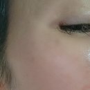 맑은약국 | 환절기피부뒤집어짐? 아줄렌엑소좀앰플 14일 사용후기 (약국화장품추천)