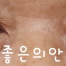 좋은의안 이미지