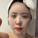강한피부과의원 | 신사역피부과 세레아의원 인모드모피우스 후기 예신 리프팅 솔직후기