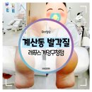 레푸스 계양구청점 | 계산동 발각질 :: 발뒤꿈치 굳은살 발각질제거 레푸스 계양구청점 리얼후기