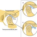 프롤로의원 | 부천 턱관절 주사 pdrn 주사요법, 프롤로테라피