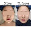 동남로18길 | 개롱윤곽관리 디어림💆‍♀️얼굴윤곽 리프팅+승모근 관리 리얼후기!예비신부라면 무조건