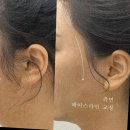 리그로브 왁싱 후기: 대구에서 경험한 최고급 왁싱과 편안한 시술 환경