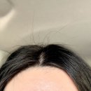 수헤어라인 | 창원서상동왁싱 창원중동왁싱잘하는곳 윈썸제이 슈가링으로 매끈해진 헤어라인 후기