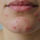 라인약국 이미지