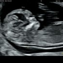 이경미산부인과의원 | 임신 초기 검사ㅣ초음파 검사 주기ㅣ1차 기형아 검사ㅣ검사 비용