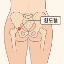 환도약국 | 임산부 환도선다, 통증 원인과 확실한 완화법 총정리