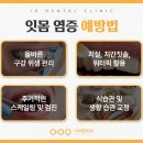 e-하얀치과의원 | 광주일요일치과 잇몸 염증 치주 질환 예방이 최선의 치료입니다