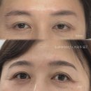 304-운정-304 네이버블로그