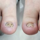 레푸스 화정점 이미지