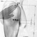 오십견(견응증, 견통)과 목 디스크 침구치료, 경박신경통(어깨팔 증후군) 이미지