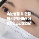 블리젠스테이