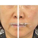 로이코스메틱 이미지