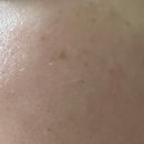 베스트메디필 | 크림 추천!]다이소 메디필 멜라논 엑스 기미 스팟 젤...기미 잡티 박멸 도전! (내돈내산 솔직 후기)