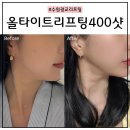 진중메디칼 | [광교] 수원 피부과 추천 | 울쎄라 써마지 장점만 담은 올타이트리프팅 후기