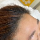 비움헤어 - 연수구 송도과학로27번길 55 | 춘천 비움왁싱 헤어라인왁싱 내돈내산 후기
