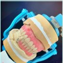 시온치과기공소 이미지