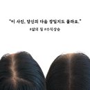 세종기술 | 대전 세종 오송 신탄진 두피문신 세밀함이 다르다, 진짜 모근 밀도 기술 – 세종 가르마 SMP 후기