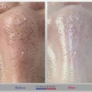 피부빛나다 이미지