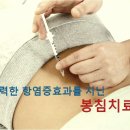 ﻿봉침, 알면 약 모르면 독 이미지