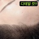 헤어라인 문신 부작용 실패한 어설픈 라인에 전문가도 화가납니다