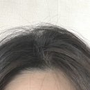 리페어링 이미지